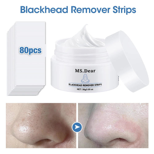 Bare Theory Deep Pore Ritual Set – Blackhead Remover Cream & Pore Strip Kit